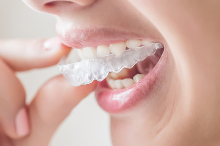 歯周病・口臭の再発を防ぐ「3DS」